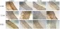 Anti-Osteopontin SPP1 Rabbit Monoclonal Antibody